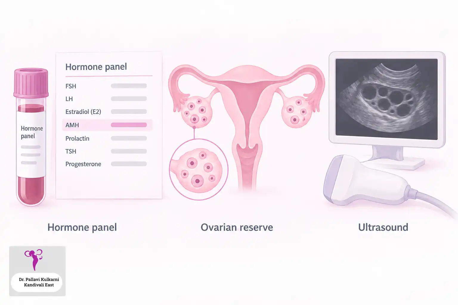 A fertility work up: a blood sample and hormone panel report, an ovary showing its resting follicles as a marker of ovarian reserve, and an ultrasound scan