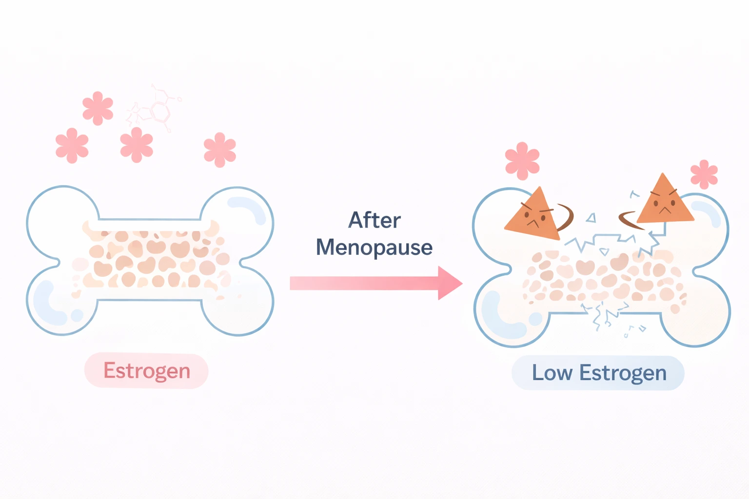 Joint pain and bone health in menopause