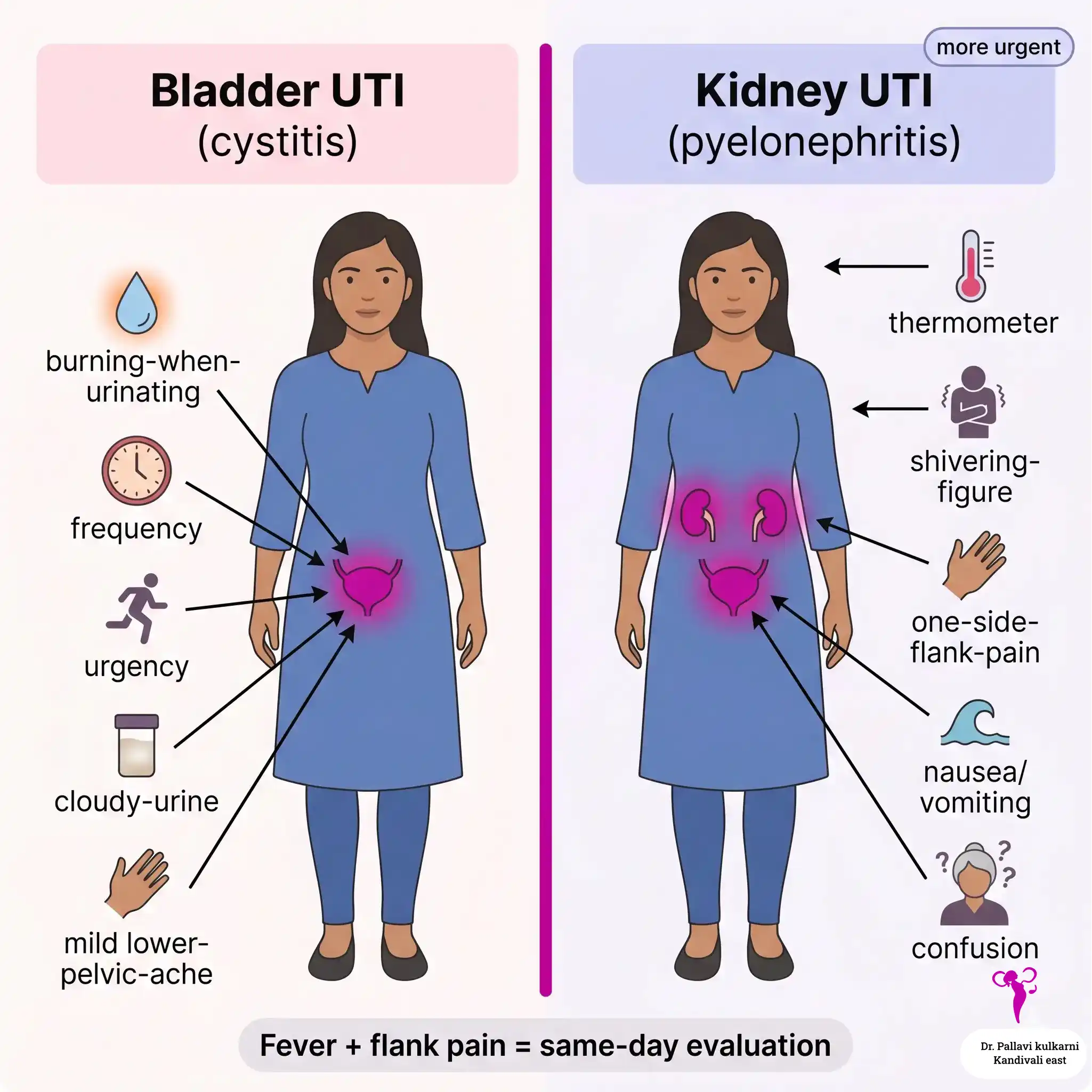Side by side comparison illustration showing symptoms of bladder UTI and kidney UTI in women